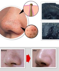 Efinny Blackhead Remover Cream Deep Clean Purifying Peel Acne Black Mud Face .. 3 182291163154 1