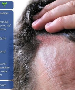 Seborrheic Dermatitis Face Wash (4 Oz) By Phat 5.5 4 Oz 9 182299394751 2