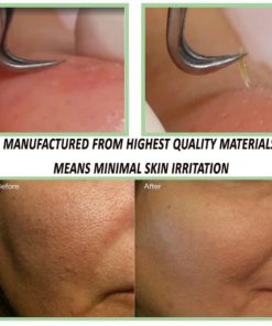 Blackhead Tweezer - Professional Curved Steel Tip Surgical Comedone & Splinte.. 9 182299424378 2