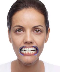 Alternative view of 15 Pack Dental Cheek Retractor For Watch Ya Mouth/Speak Out Game C-Shape Adul..