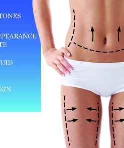 Thin Botanicals-Best Anti-Cellulite Cream On Amazon That Works-Breaks Down Ex.. 12 57 3f1333d7 b067 4d64 8880 5529900c2d69