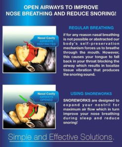 Snoreworks - Set Of 4 Premium Anti Snore Aid To Prevent Snoring Deviated Sept.. 8 57 48434619 8c8f 4ffe 895c 1acb5c394125
