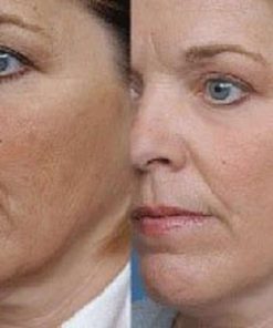 Needcrystals Microdermabrasion Crystals Exfoliating Facial Scrub Skin Care Re.. 9 57 5dd3598a 9ebf 45ac 9071 a1216225a615