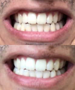 Oral Essentials Teeth Whitening Mouthwash 16 Oz. For Daily Use Without Sensit.. 13 57 6f327896 7397 4b5b 9192 d971c4fb5e10