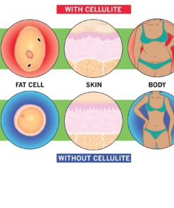 Thin Botanicals-Best Anti-Cellulite Cream On Amazon That Works-Breaks Down Ex.. 10 57 c6cfa297 9abc 4aad b014 f346ceb3e43d