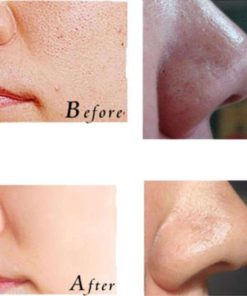 57 d6201fe7 e247 4ccb b2de a488d95e858d 1