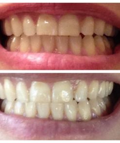 Oral Essentials Teeth Whitening Mouthwash 16 Oz. For Daily Use Without Sensit.. 12 57 ff045feb a537 4d3e aede bbf15b3d2cfc