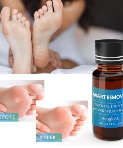 Evagloss Wart Remover Liquid - Maximum Strength- Painlessly Removes Common and Plantar Warts- BONUS Cotton Swabs 11 717sJGNrlgL