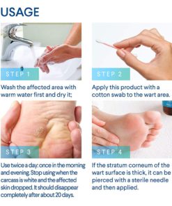 Evagloss Wart Remover Liquid - Maximum Strength- Painlessly Removes Common and Plantar Warts- BONUS Cotton Swabs 10 71VBZ0sZQXL