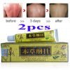 Psoriasis Creams Dermatitis and Eczema Pruritus Psoriasis CEZUBEM Ointment 2pcs/Lot High Quality Chinese Herbal Eczema, 13 71ufHmZyOjL