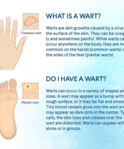 Evagloss Wart Remover Liquid - Maximum Strength- Painlessly Removes Common and Plantar Warts- BONUS Cotton Swabs 13 71uvspFFg1L