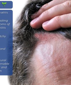 Seborrheic Dermatitis Cream with Manuka Honey, Coconut Oil and Aloe Vera - Moisturizing Face and Body Anti Itch Cream and Skin Treatment for Sensitive Skin - Natural & Organic Cream (2 oz) 2 Ounce 14 91I1YFxIfPL