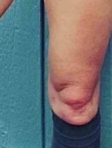 Gold Bond Age Renew Retinol Overnight Body & Face Lotion, With Retinol & Peptide Complex, 7 oz. 7 Fl Oz (Pack of 1) 35 216m6xEQFZL 2