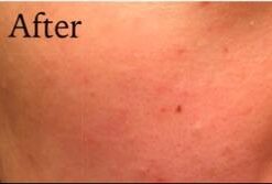 Labo Labo Super Pores Lotion, 100ml 23 21lIWlSXZyL