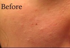 Labo Labo Super Pores Lotion, 100ml 25 21yu0pal44L