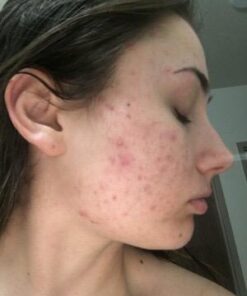 Eve Hansen Hyaluronic Acid Serum for Face (2 oz) | Hydrating Face Serum with Vitamin C + E, Wrinkle Filler, Moisturizer, and Natural Plumper | Cruelty Free, Vegan Anti Aging Serum 2 Fl Oz (Pack of 1) 47 316T1ZlKoUL