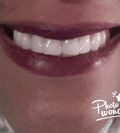 PHILIPS Zoom Nite White 22% 3 Syringes 18 3182pzzePkL