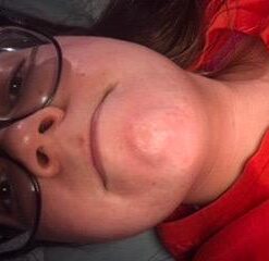 Obagi CLENZIderm M.D. Daily Care Foaming Acne Face Wash 4 Fl Oz (Pack of 1) 26 319empYAGuL