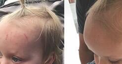 Active Skin Repair First Aid Scar Shield Hydrogel - Scar Treatment for Cuts, Scrapes, Burns and Other Wounds to Stop Scars BEFORE They Form - Natural and Non-Toxic Scar Prevention Gel (3 oz Gel) 25 31ChSrtbOoL