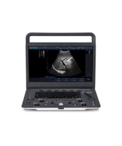 SonoScape A6V Expert E1V Veterinary Ultrasound & One Rectal L741V Probe 9 31H mZ1NtpL