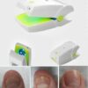 Nail Fungus Laser Treatment Instrument Onychomycosis Cure Non Invasive Safe No Side Effects
