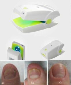 Nail Fungus Laser Treatment Instrument Onychomycosis Cure Non Invasive Safe No Side Effects