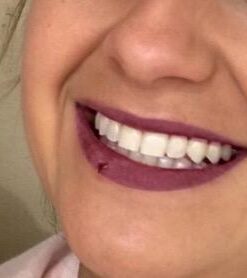 PHILIPS Zoom Nite White 22% 3 Syringes 16 31o6lSLpIOL