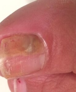 3 in 1 Professional Foot Spa Kit-with Tea Tree Foot & Body Soak-Tea Tree Body Wash & Nail Blend-Soothes Dry, Burning & Itchy Skin-Refreshes Unwanted Foot Odor-Restores Unhealthy Nails-Purely Northwest Tea Tree Oil 3 Piece Set 44 41 Qh3mI6DL