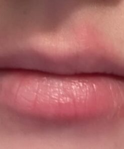 Dr. Dan's Cortibalm - 1 Pack - for Dry Cracked Lips - Healing Lip Balm for Severely Chapped Lips - Designed for Men, Women and Children 0.14 Ounce (Pack of 1) 32 41 zfwkV9yL