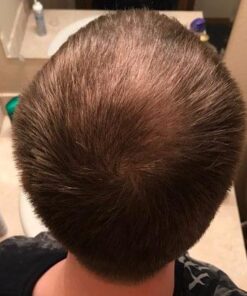 Men's Rogaine 5% Minoxidil Foam for Hair Loss and Hair Regrowth, Topical Treatment for Thinning Hair, 3-Month Supply, 2.11 Ounce (Pack of 3) Men's Rogaine Foam Treatment (3-Month Supply) 2.11 Ounce (Pack of 3) 46 416 Kp8EqCL