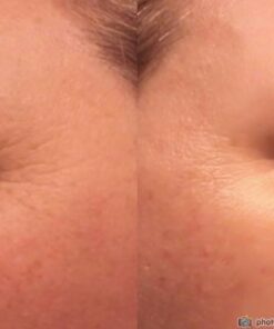 L'Oréal Paris Revitalift Bright Reveal Anti-Aging Exfoliating Peel Pads with Glycolic Acid, Reduce Wrinkles & Brighten Skin, 30 Count (Pack of 1) 43 418eyNNGwgL