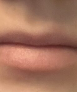 Dr. Dan's Cortibalm - 1 Pack - for Dry Cracked Lips - Healing Lip Balm for Severely Chapped Lips - Designed for Men, Women and Children 0.14 Ounce (Pack of 1) 33 4192nwMp6fL