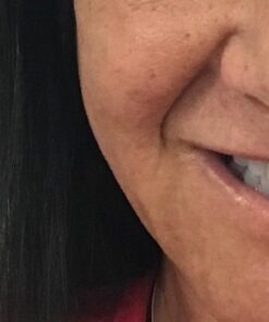 Hibiclens Antimicrobial Skin Liquid Soap, Unscented 32 Fl Oz 24 41CpgkBOf5L