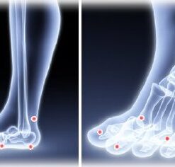 Men Size 11.5-13 HealthmateForever Acupressure Dynamic Glycerine Liquid Best Pain Relief Foot Insoles for Sore feet, Therapeutic Massaging Insoles, Help Improve Circulation, Diabetic feet Pain 12 41DF1PoMM3L