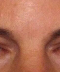 Toute Nuit Wrinkle Patches, Face Tape, Triangle - Forehead, Around Eyes and Lips - 45 Patches 45 Count (Pack of 1) 26 41Ist0GsYNL