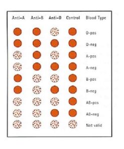 Eldoncard Blood Typing Kit, 3 Tests, Know Your Blood Type, Instant Home Testing Kit, A, O, B, Rhs-D Negative and Positive Blood Types Tested For 23 41NWRf24mrL
