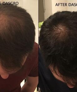 PRN Pure Results Nutrition DasGro Hair Growth Vitamins, Biotin & DHT Blocker, Stops Hair Loss, Thinning, Balding, Promotes Hair Regrowth in Men & Women, All Hair Types, 30 Day Supply 26 41PFFYeuZwL 1