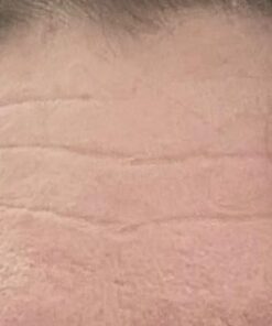 Frownies Forehead and Between Eyes Wrinkle Patches The Original Wrinkle Patch Non Invasive Wrinkle Smoothers for Forehead Wrinkles 47 41VD9acEv8L