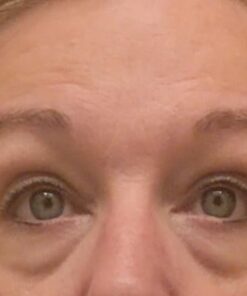 LilyAna Naturals Eye Cream for Dark Circles and Puffiness, Under Eye Cream for Wrinkles and Bags, Anti Aging Eye Cream helps Improve Dryness; for Sensitive Skin - 1.7 oz - Made in USA Rosehip and Hibiscus 1.70 Fl Oz (Pack of 1) 37 41ZuwyuQNAL