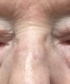 Body Merry Age Defense Eye Cream – Anti-Aging Treatment for Puffy Eyes, Dark Circles, Bags, Fine Lines and Wrinkles – Brightening Daily Face Moisturizer, 1.7 oz 49 41ekOBrmoBL