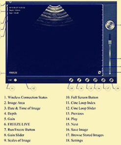 Wireless Wi-Fi Ultrasound Scanner, FMJI Veterinary Pregnancy Ecograph,3.5 Mhz/80 Element Convex Probe with Android 7" Tablet, Compatible iOS Smartphones, Tablet, for Pet&Large to Small Animals 9 41g24sStZoL