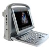 Chison ECO 5 Vet Veterinary Ultrasound Machine with One Probe at Choice 15 41jUpj4cKNL