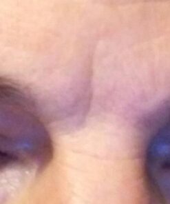 Toute Nuit Wrinkle Patches, Face Tape, Triangle - Forehead, Around Eyes and Lips - 45 Patches 45 Count (Pack of 1) 27 41ka39scykL