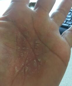 MG217 Multi Symptom Relief 2% Coal Tar Medicated Psoriasis Ointment oz Jar, 4 Oz 4 Ounce (Pack of 1) 40 41rnGAhrRUL