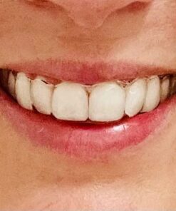 Opalescence 35% Gel Syringes Teeth Whitening - Refill Kit (4 Packs / 8 Count) Carbamide Peroxide. Made by Ultradent, in Cool Mint Flavor. Tooth Whitening Refill Syringes 5197-4 Mint 35 8 Count (Pack of 1) 19 511wdvVVVL