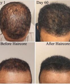 Haircore XL: DHT Blocker, Stops Hair Loss, Thinning, Balding, Repairs Hair Follicles, Promotes New Hair Growth, Regrow Hair, Men & Women, All Hair Types, 30 Day Supply 8 514 tysK9sL