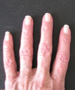 Amazing Formulas Biotin 10000mcg 200 Veggie Capsules Supplement | Non GMO | Gluten Free | Made in USA | Suitable for Vegetarians 200 Count (Pack of 1) 24 516wn5gVJQL