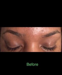 NOW Solutions, Castor Oil, 100% Pure Versatile Skin Care, Multi-Purpose Skin Softener, 16-Ounce 16 Fl Oz (Pack of 1) Standard Packaging 31 5170WFKw7BL