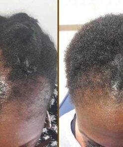 PRN Pure Results Nutrition DasGro Hair Growth Vitamins, Biotin & DHT Blocker, Stops Hair Loss, Thinning, Balding, Promotes Hair Regrowth in Men & Women, All Hair Types, 30 Day Supply 29 517927HGPpL 1