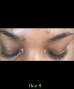 NOW Solutions, Castor Oil, 100% Pure Versatile Skin Care, Multi-Purpose Skin Softener, 16-Ounce 16 Fl Oz (Pack of 1) Standard Packaging 32 517HWMuvBML